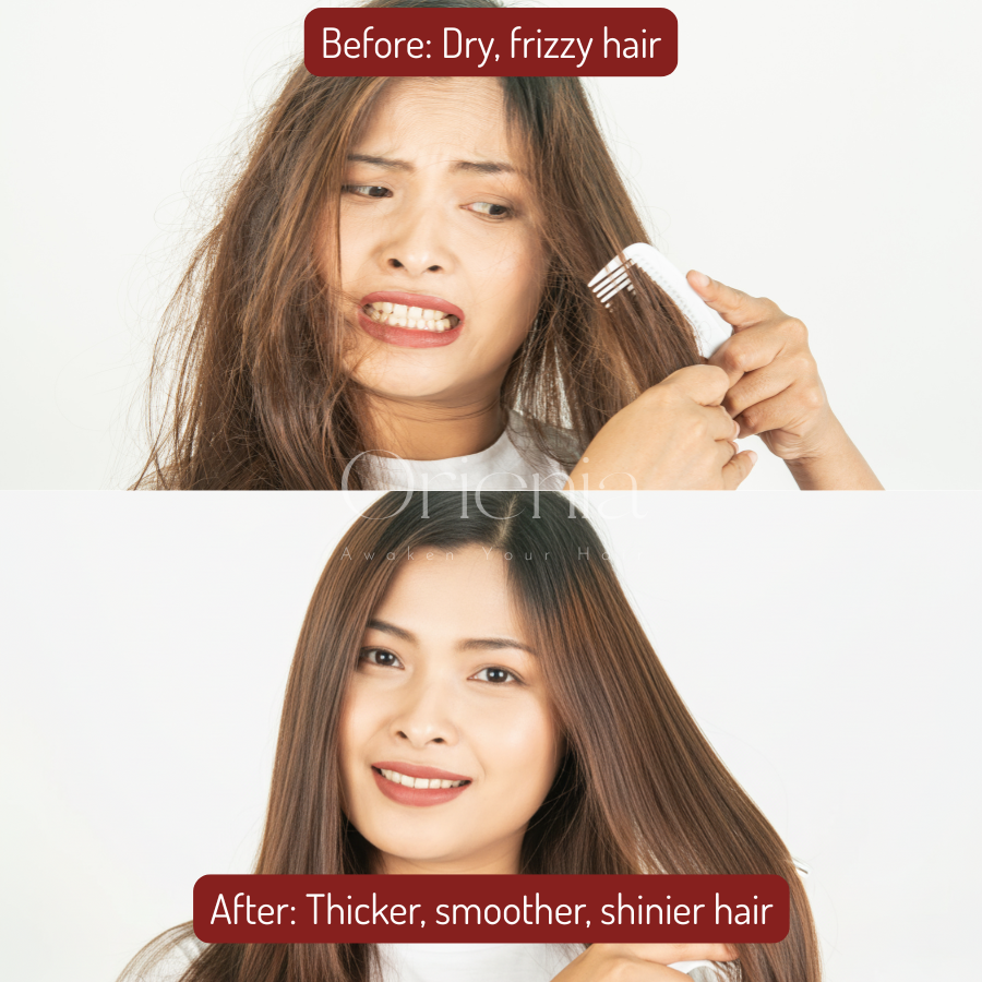 Orienia Scalp Massager