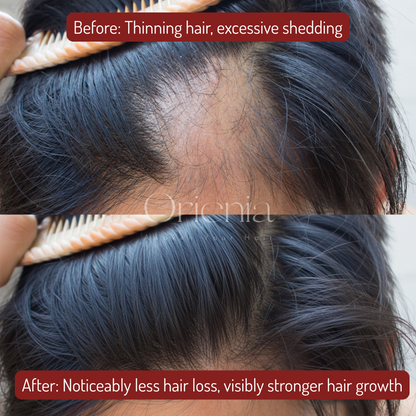 Orienia Scalp Massager