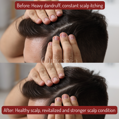 Orienia Scalp Massager